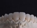 stillo-aplicacao-ceramica-caso-4-1